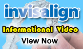 Invisalign Video