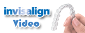 Invisalign Video