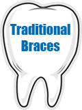 Traditional Braces
