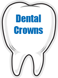 Dental Crowns