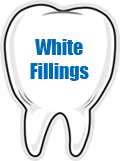 White Fillings
