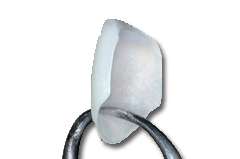 Lumineer Close-Up Image