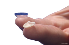 Lumineers size compared with contact lens